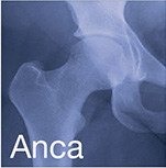 anca