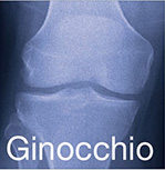 ginocchio