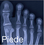 piede