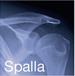 spalla